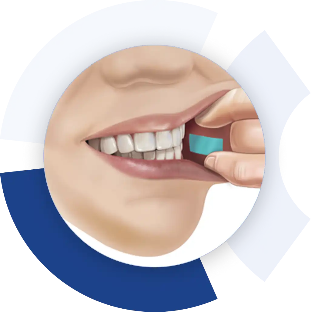 Buccal administration