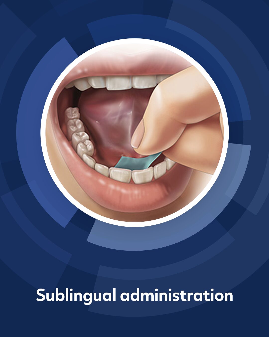 Image labeled "sublingual adminstration" showing a pharmfilm strip being applied under the tongue