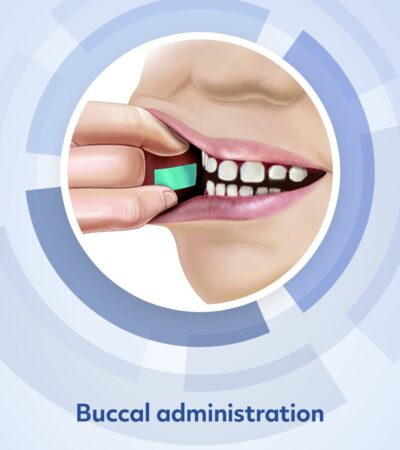 Image labeled "buccal administration", showing a pharmfilm strip being applied to the inside of the cheek.