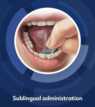 Image labeled "sublingual adminstration" showing a pharmfilm strip being applied under the tongue